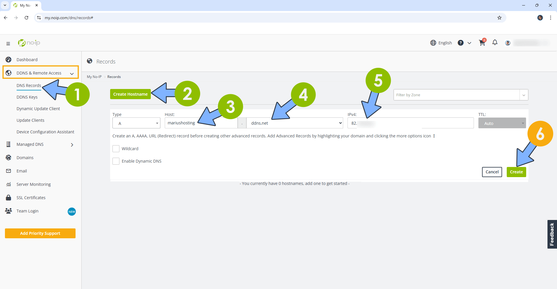 How To Enable HTTPS on Your UGREEN NAS 2 New 2026