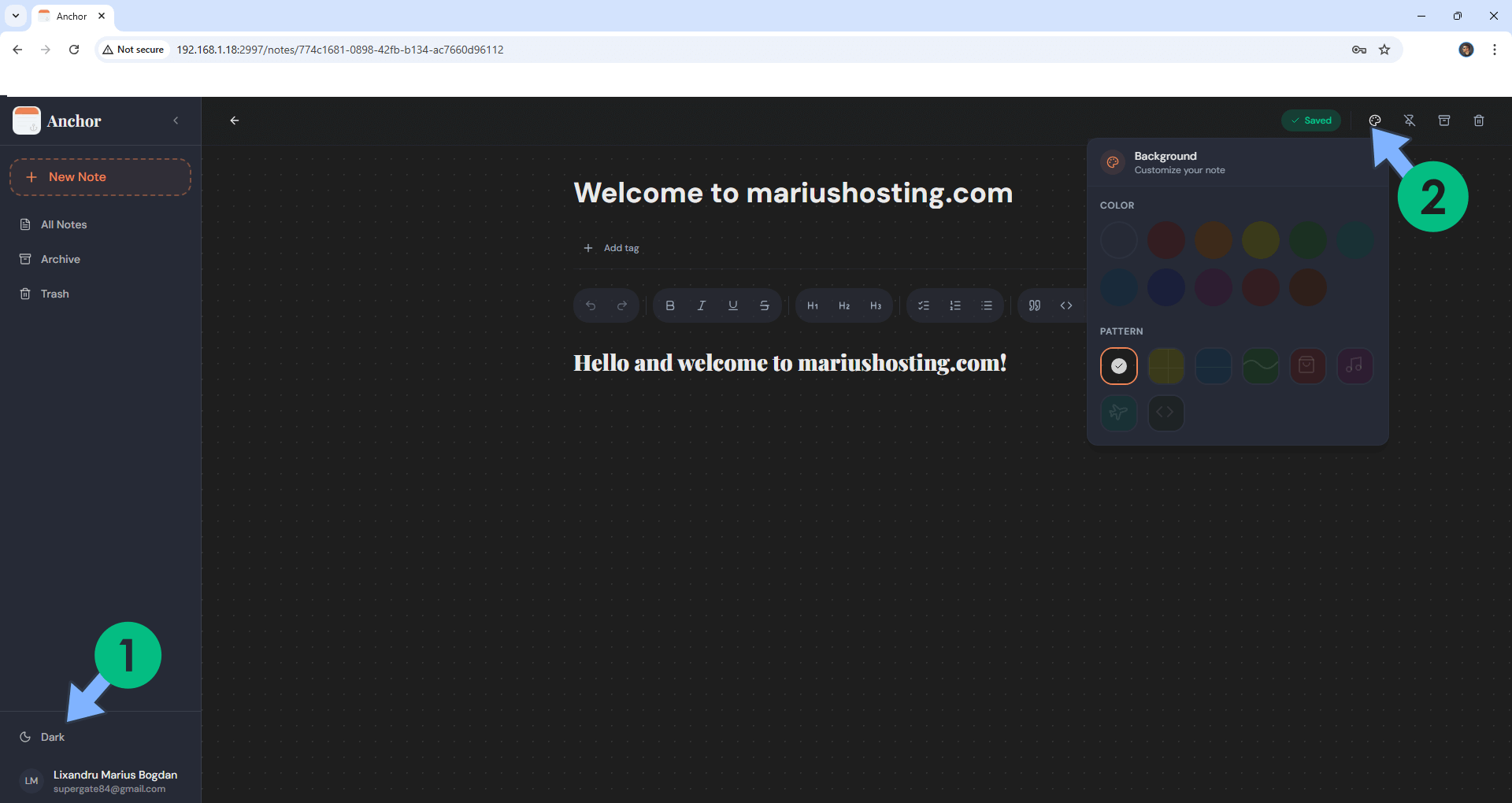 Anchor Synology NAS Set up 6