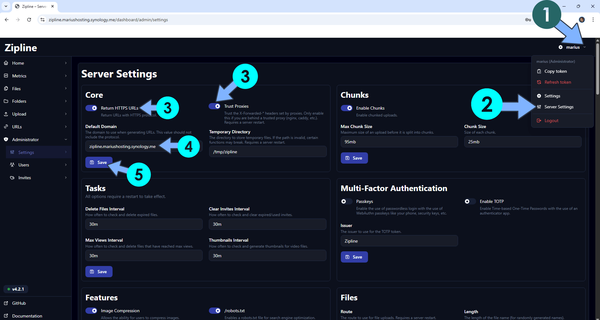 Zipline Synology NAS Set up 14 new 2026